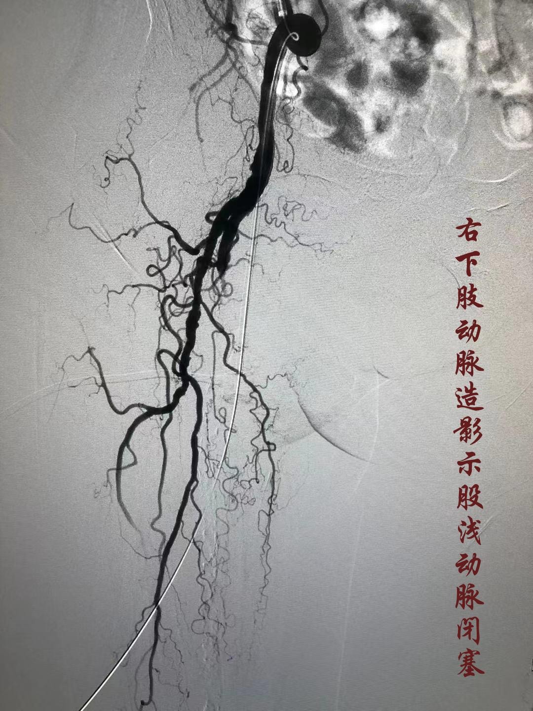 泌尿系统1 - 知乎